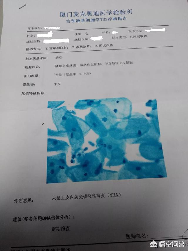 自媒体女王咪蒙得了宫颈癌前病变，哪些人容易患这病？